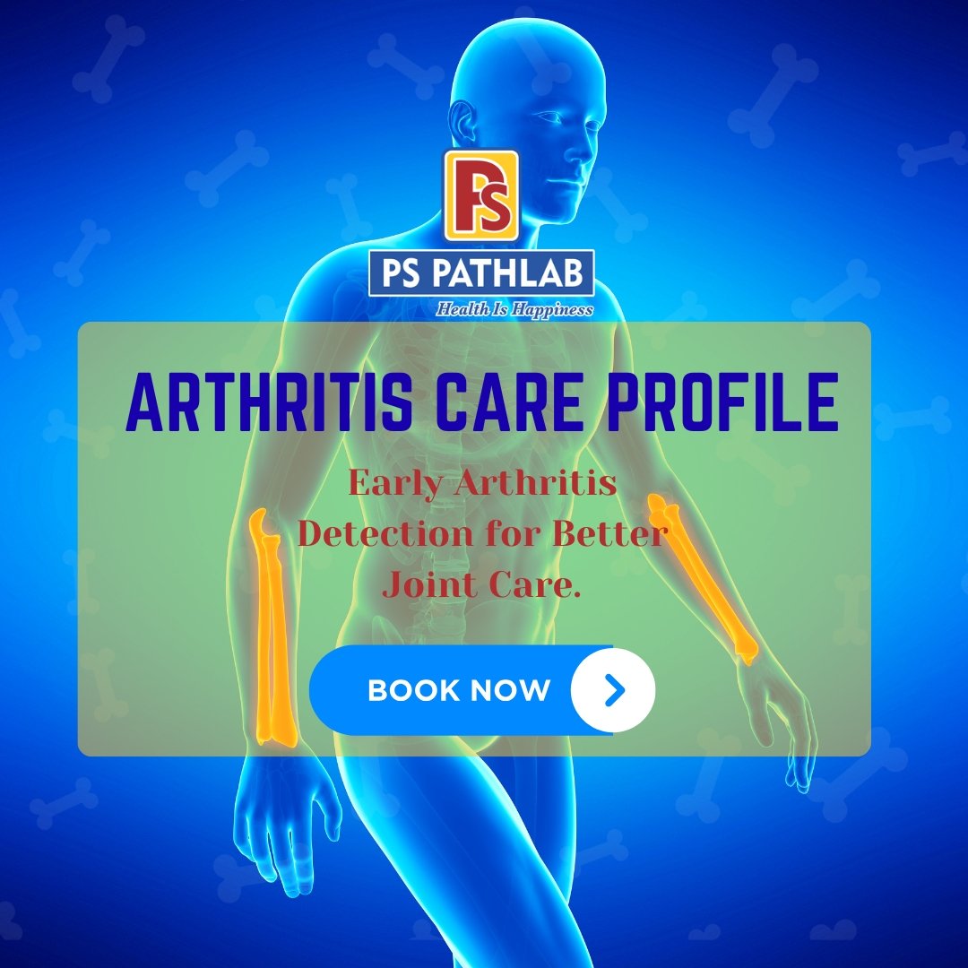 ARTHRITIS CARE PROFILE
