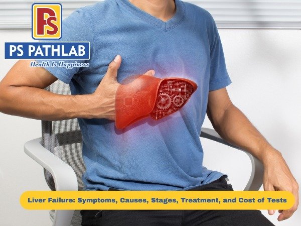 Liver Failure: Symptoms, Causes, Stages, Treatment, and Cost of Tests