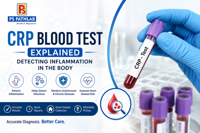 CRP Blood Test Explained: Normal Range, Uses & Inflammation Detection | PS PathLab