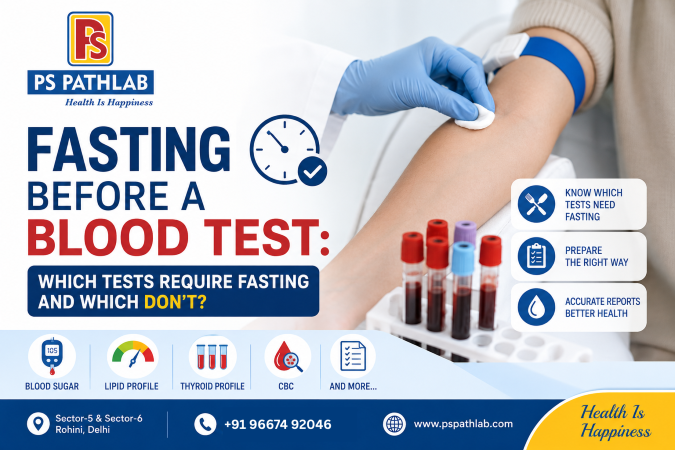 Fasting Before a Blood Test: Which Tests Require Fasting and Which Don’t?