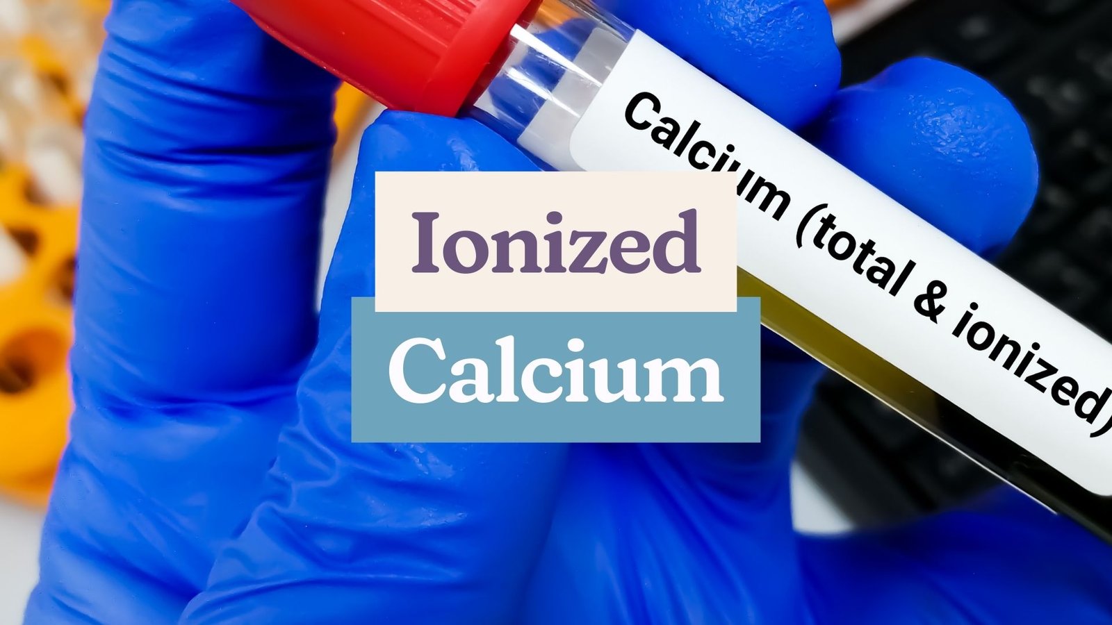 IONIZED CALCIUM 