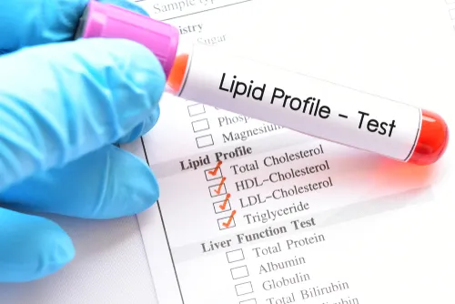 LIPID PROFILE
